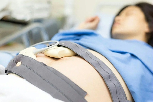 胎心监护仪